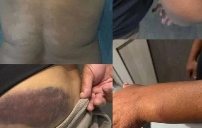 Segurança pública na gestão Ratinho Júnior segue um estereótipo para abordagem?